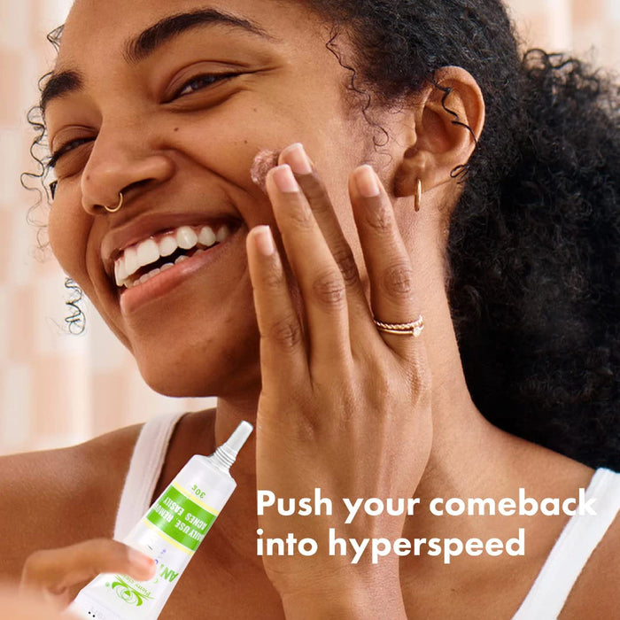 30g Acne Cream soothes