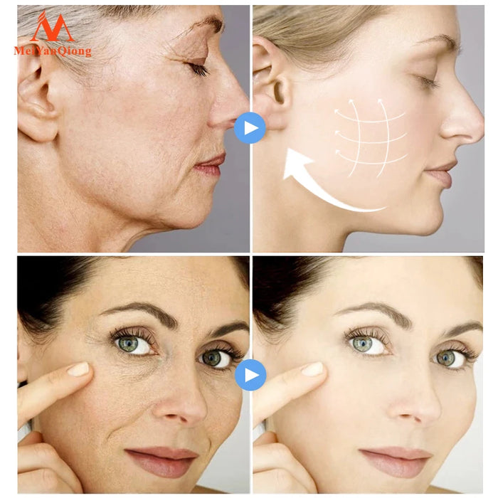Face-lift Cream Slimming Face Lifting