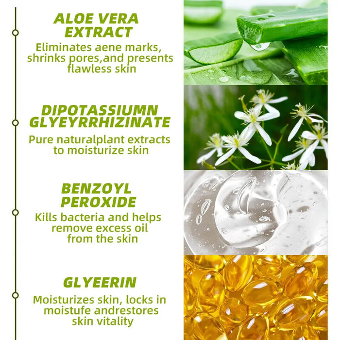30g Acne Cream soothes